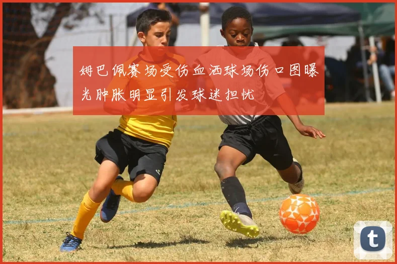 姆巴佩赛场受伤血洒球场伤口图曝光肿胀明显引发球迷担忧